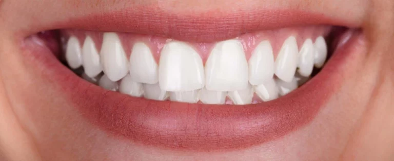 White beautiful Teeth
