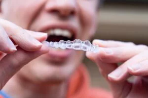 adult putting in clear braces into mouth