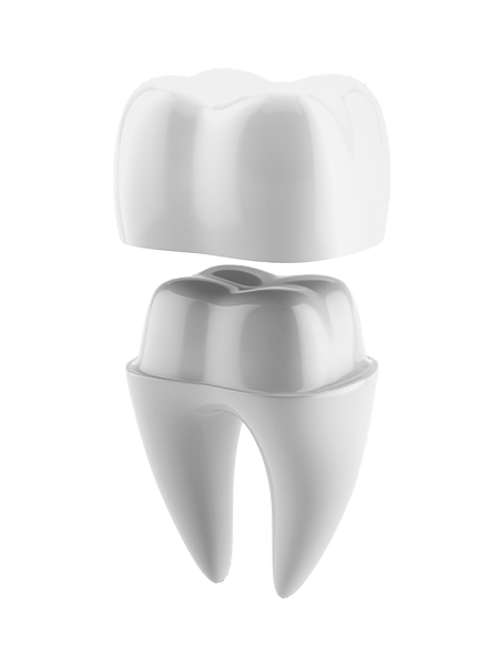 image of a tooth getting a dental crown installed