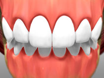 teeth and jaw repaired at piedmont dental