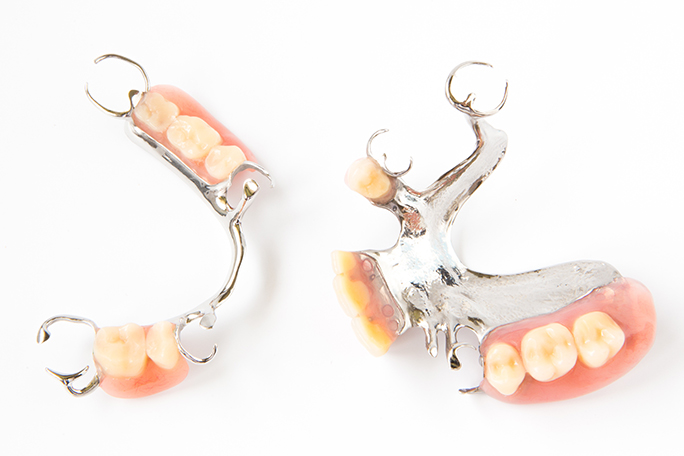 Partial dentures that are removable created at piedmont dental in rock hill, sc