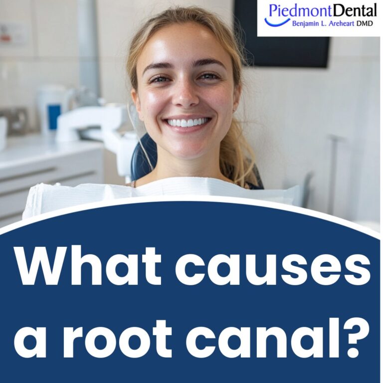 What causes a root canal?