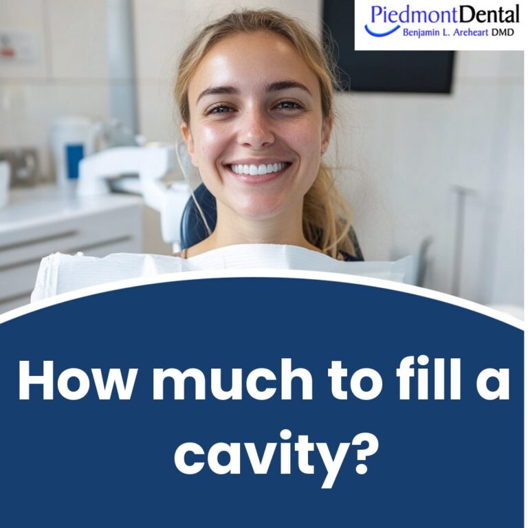 How much to fill a cavity?