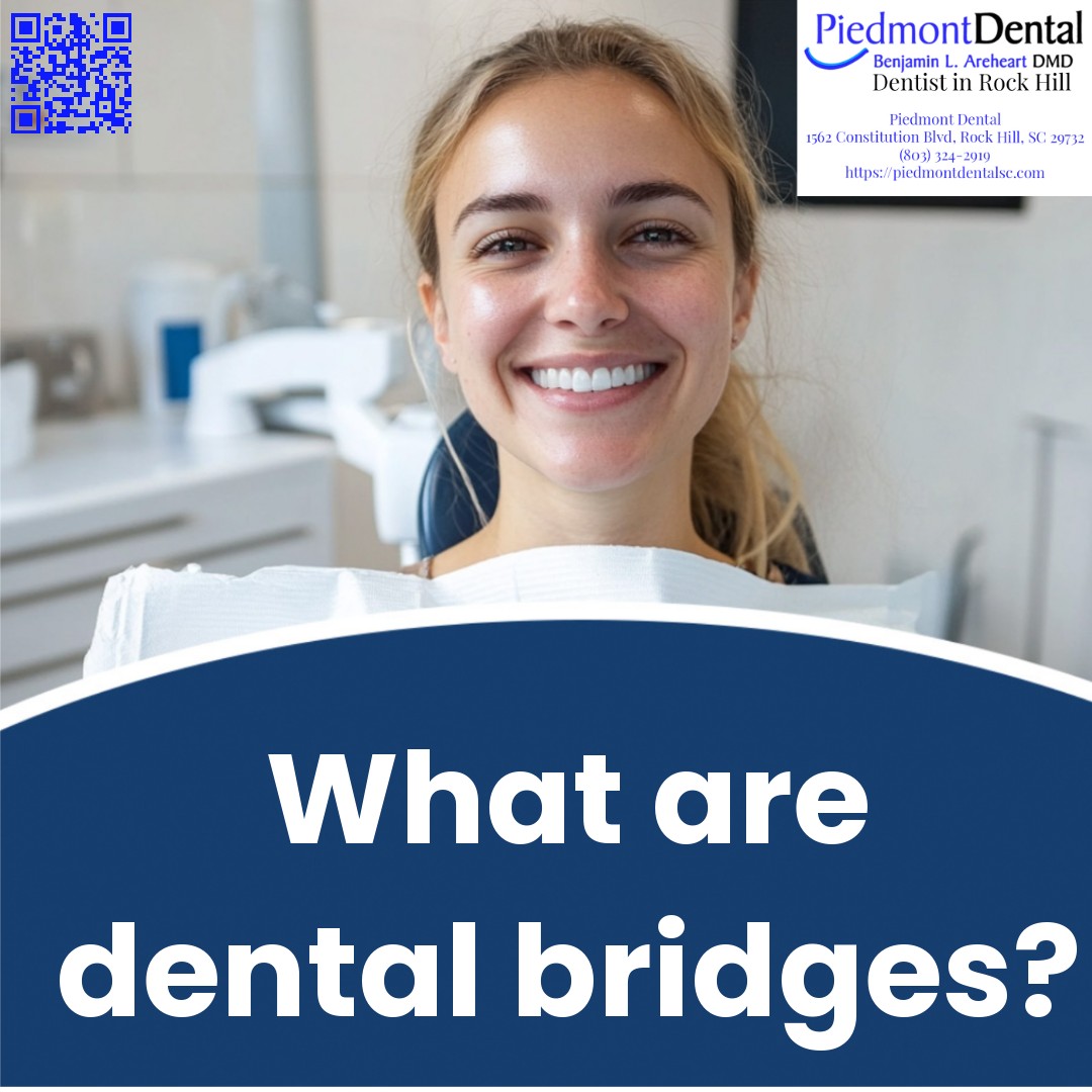 What are dental bridges?