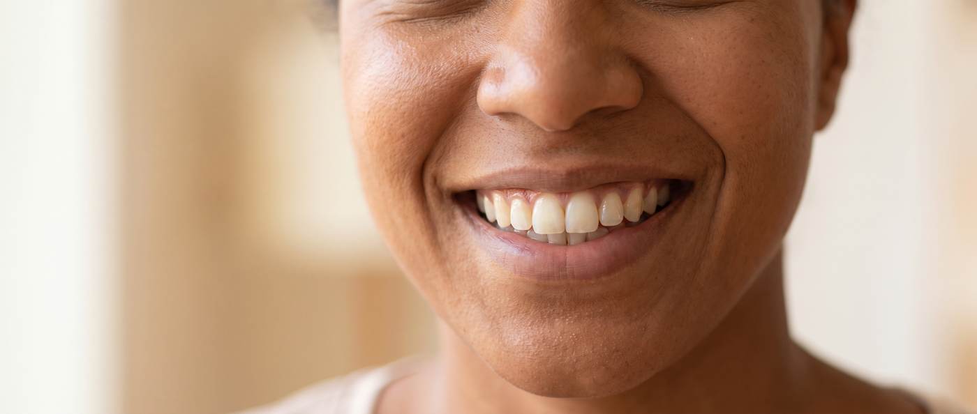 A confident natural smile after cosmetic dentistry