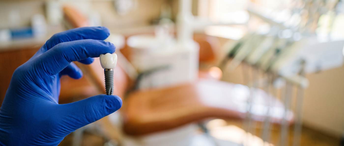 Dental implant with crown held in a gloved hand
