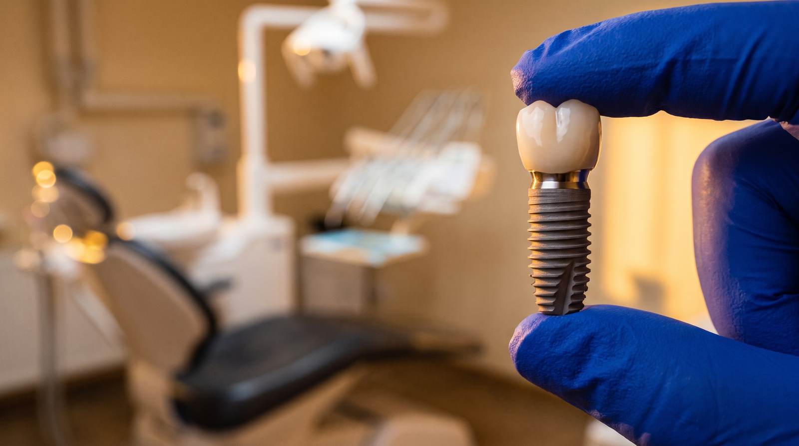 A dental implant with crown in a gloved hand