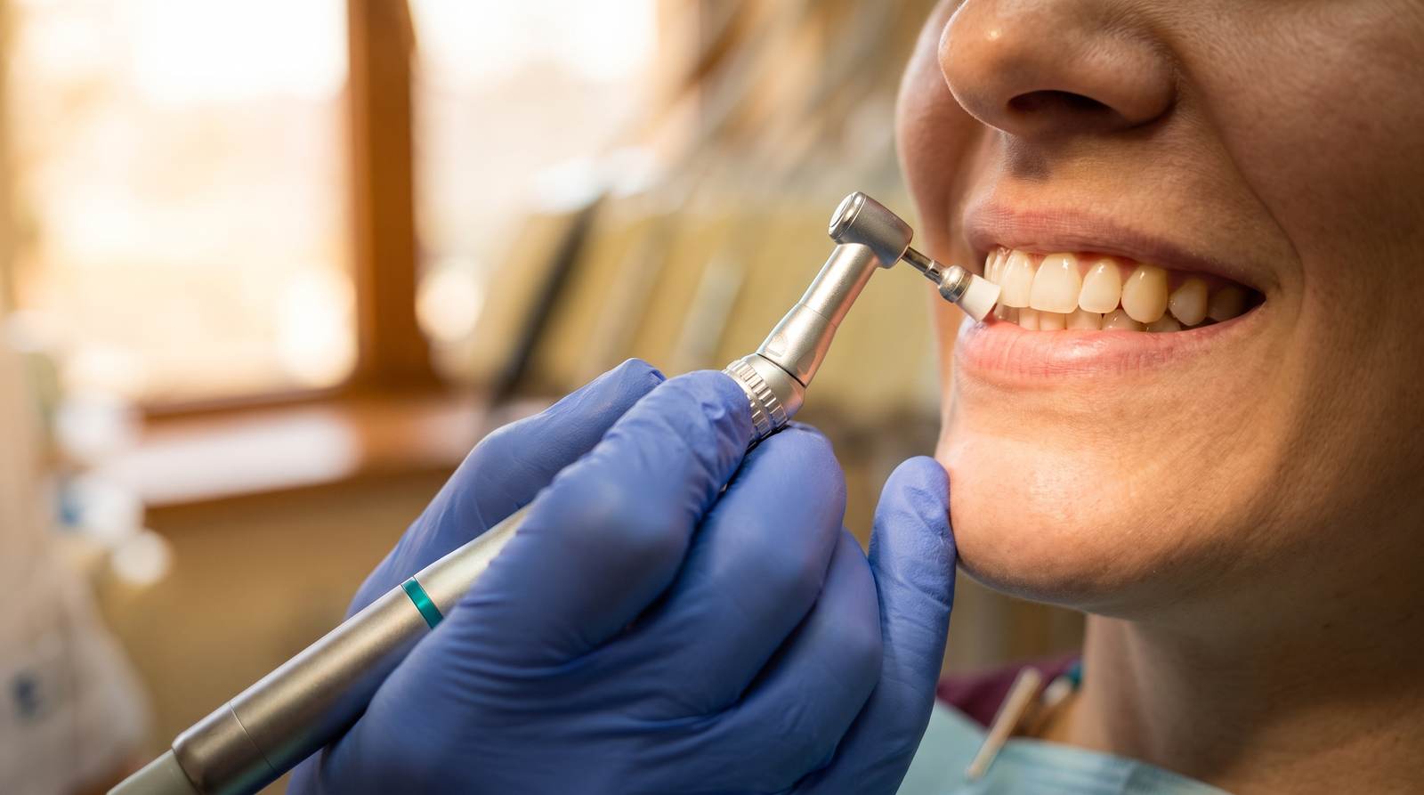 A gentle polish during a dental cleaning at Piedmont Dental in Rock Hill